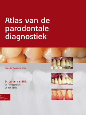 cover image of Atlas van de parodontale diagnostiek